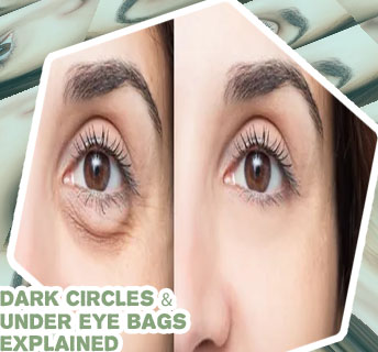 Dark under eye treatment